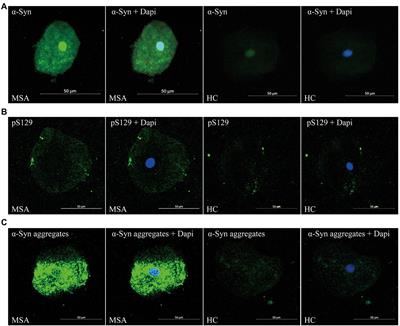 Alpha-Synuclein species in oral mucosa as potential biomarkers for multiple system atrophy